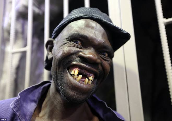 Maison Sere, ugliest man in Zimbabwe 